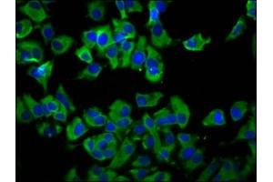 Immunofluorescence staining of MCF-7 cells with ABIN7173159 at 1:66, counter-stained with DAPI. (TMEM231 Antikörper  (AA 161-261))