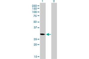 Western Blot analysis of CDC2 expression in transfected 293T cell line by CDC2 monoclonal antibody (M01), clone 1A4-1A9. (CDK1 Antikörper  (AA 1-297))