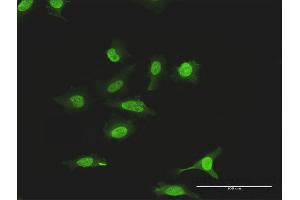 Immunofluorescence of purified MaxPab antibody to SUMO2 on HeLa cell. (SUMO2 Antikörper  (AA 1-95))