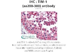 Image no. 1 for anti-Hepatitis A Virus Cellular Receptor 1 (HAVCR1) (AA 200-300) antibody (ABIN1740077) (HAVCR1 Antikörper  (AA 200-300))