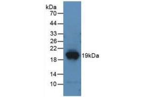 Western blot analysis of recombinant Mouse DPP4. (DPP4 Antikörper  (AA 29-178))