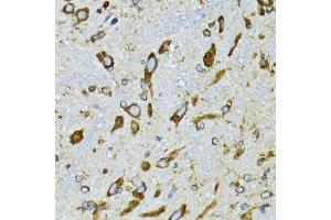 Immunohistochemistry (Paraffin-embedded Sections) (IHC (p)) image for anti-Ribophorin 1 (RPN1) (AA 20-280) antibody (ABIN6147170)