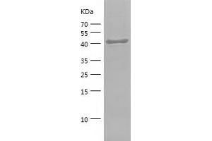 Western Blotting (WB) image for CD44 (CD44) (AA 152-311) protein (His-IF2DI Tag) (ABIN7122208) (CD44 Protein (CD44) (AA 152-311) (His-IF2DI Tag))