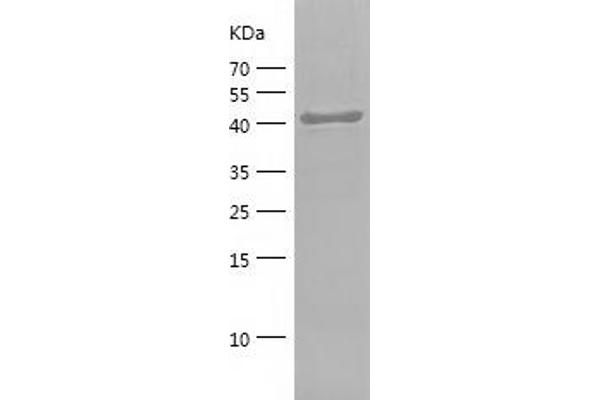 CD44 Protein (CD44) (AA 152-311) (His-IF2DI Tag)