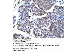 Human Pancreas (CTBP1 Antikörper  (C-Term))