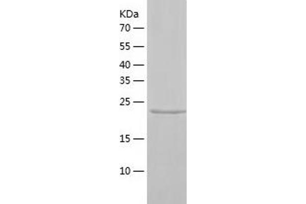 XIAP Protein (AA 120-356) (His tag)