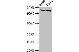 Western Blot Positive WB detected in: A549 whole cell lysate, Hela whole cell lysate All lanes: EML4 antibody at 3 μg/mL Secondary Goat polyclonal to rabbit IgG at 1/50000 dilution Predicted band size: 109, 103 kDa Observed band size: 109 kDa (EML4 Antikörper  (AA 1-62))