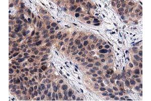 Image no. 3 for anti-Acyl-CoA Thioesterase 12 (ACOT12) antibody (ABIN1496414) (ACOT12 Antikörper)