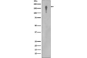 Western blot analysis of EGFR in A431 cell lysate. (Rekombinanter EGFR Antikörper)