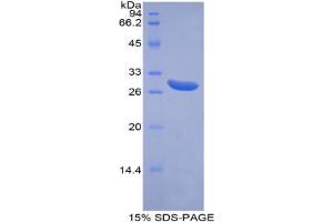 SDS-PAGE analysis of Human ABCG1 Protein. (ABCG1 Protein)