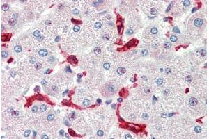 Human Liver (formalin-fixed, paraffin-embedded) stained with HMOX1 antibody ABIN462109 at 10 ug/ml followed by biotinylated goat anti-rabbit IgG secondary antibody ABIN481713, alkaline phosphatase-streptavidin and chromogen. (HMOX1 Antikörper)