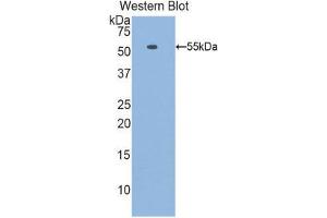 Western Blotting (WB) image for anti-Laminin, beta 1 (LAMB1) (AA 1053-1258) antibody (ABIN1859602) (Laminin beta 1 Antikörper  (AA 1053-1258))