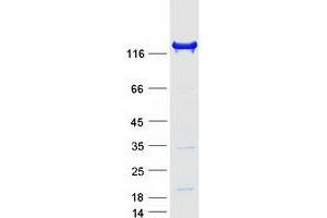 Western Blotting (WB) image for Inositol Polyphosphate-5-Phosphatase, 145kDa (INPP5D) (Transcript Variant 2) protein (Myc-DYKDDDDK Tag) (ABIN2723485)