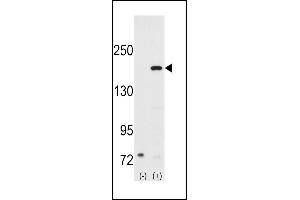Western blot analysis of SRC1 (arrow) using rabbit polyclonal SRC1 Antibody (N-term) (ABIN391824 and ABIN2841669). (NCOA1 Antikörper  (N-Term))