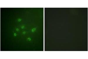 Immunofluorescence analysis of A549 cells, using DAPK3 (Phospho-Thr265) Antibody.