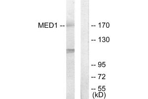 Western blot analysis of extracts from Jurkat cells, using MED1 antibody. (MED1 Antikörper  (Internal Region))