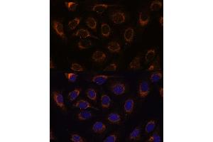 Immunofluorescence (IF) image for anti-T-Cell, Immune Regulator 1, ATPase, H+ Transporting, Lysosomal V0 Subunit A3 (TCIRG1) (AA 1-130) antibody (ABIN7270707)