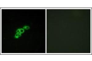 Immunofluorescence analysis of MCF7 cells, using FSHR Antibody. (FSHR Antikörper  (Internal Region))