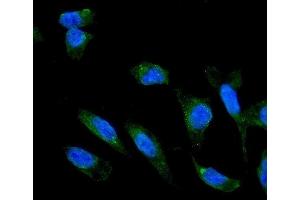 IF analysis of ADIPOR1 using anti-ADIPOR1 antibody (ABIN3043520). (Adiponectin Receptor 1 Antikörper  (N-Term))