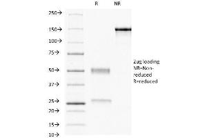 SDS-PAGE Analysis Purified Progesterone Receptor Mouse Monoclonal Antibody (PR484). (Progesterone Receptor Antikörper)