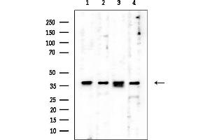 Western blot analysis of lysates from various samples, using CAPG Mouse Monoclonal Antibody at 1/1000 dilution.