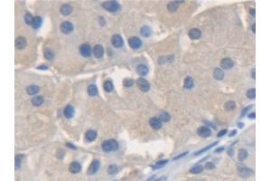 Detection of NSF in Human Stomach Tissue using Polyclonal Antibody to N-Ethylmaleimide Sensitive Factor (NSF) (NSF Antikörper  (AA 590-744))