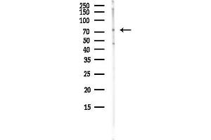 anti-PAN3 Poly(A) Specific Ribonuclease Subunit Homolog (PAN3) antibody