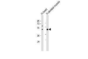 All lanes : Anti-ISLR Antibody (C-term) at 1:1000 dilution Lane 1: human heart lysate Lane 2: human skeletal muscle lysate Lysates/proteins at 20 μg per lane. (ISLR Antikörper  (C-Term))