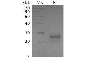 Western Blotting (WB) image for Ectodysplasin A2 Receptor (EDA2R) protein (His tag) (ABIN7320722)
