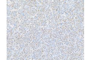 Immunohistochemistry (IHC) image for anti-Proteasome (Prosome, Macropain) 26S Subunit, Non-ATPase, 1 (PSMD1) (AA 903-953) antibody (ABIN7453570)