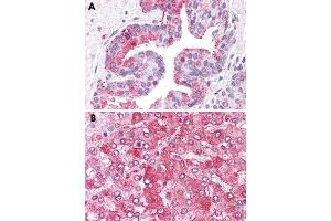 Immunohistochemical staining of formalin-fixed, paraffin-embedded human prostate (A) and human liver (B) tissue after heat-induced antigen retrieval. (ERAP1 Antikörper  (Internal Region))