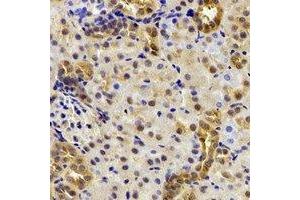 Immunohistochemical analysis of DDX39A staining in mouse kidney formalin fixed paraffin embedded tissue section. (DDX39 Antikörper)