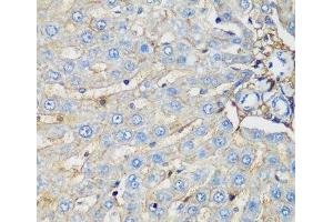 Immunohistochemistry of paraffin-embedded Rat liver using PROCR Polyclonal Antibody at dilution of 1:200 (40x lens). (PROCR Antikörper)