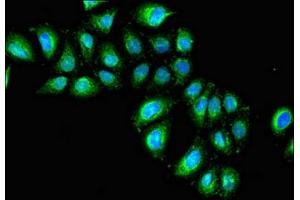 Immunofluorescent analysis of A549 cells using ABIN7156745 at dilution of 1: 100 and Alexa Fluor 488-congugated AffiniPure Goat Anti-Rabbit IgG(H+L) (IL1R1 Antikörper  (AA 18-320))