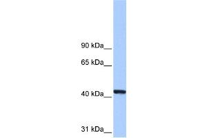 WB Suggested Anti-PGK1 Antibody Titration: 0. (PGK1 Antikörper  (N-Term))