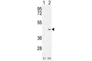 Western blot analysis of ADH4 (arrow) using rabbit polyclonal ADH4 Antibody (C-term) . (ADH4 Antikörper  (C-Term))