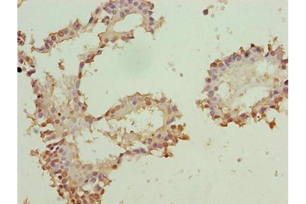 ZNF184 antibody  (AA 1-751)