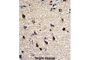 Immunohistochemistry (IHC) image for anti-Dermatopontin (DPT) antibody (ABIN3003244) (Dermatopontin Antikörper)
