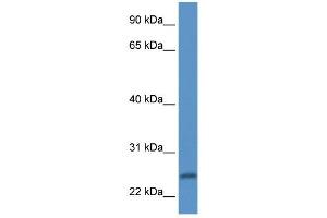 Western Blot showing PI15 antibody used at a concentration of 1 ug/ml against Fetal Heart Lysate (PI15 Antikörper  (N-Term))