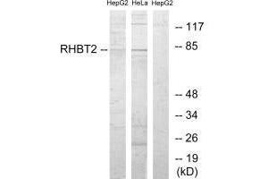 Western blot analysis of extracts from HepG2 cells and HeLa cells, using RHBT2 antibody. (RHOBTB2 Antikörper)