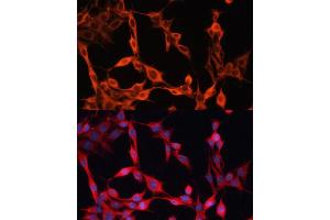 Immunofluorescence (IF) image for anti-Solute Carrier Family 25 (Mitochondrial Carrier, Phosphate Carrier), Member 23 (SLC25A23) (AA 1-160) antibody (ABIN7270435)