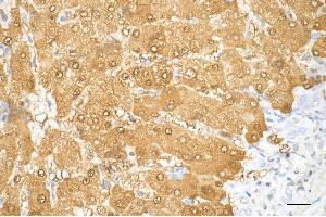 anti-Arginase, Liver (ARG1) antibody