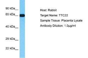 TTC22 Antikörper  (N-Term)