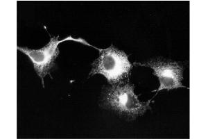 Immunofluorescence staining transiently Kv1.