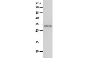 Western Blotting (WB) image for Protein Tyrosine Phosphatase, Receptor Type, N (PTPRN) (AA 693-979) protein (His tag) (ABIN7124688)