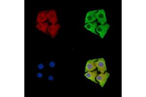 ABIN7096248 and ABIN7100310 staining Hela cells by IF/ICC. (Sbk2 Antikörper)