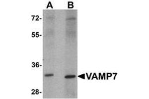 Western blot analysis of VAMP7 in mouse lung tissue lysate with VAMP7 Antibody  at 1 ug/mL.