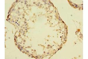 Immunohistochemistry (IHC) image for anti-Transcobalamin I (Vitamin B12 Binding Protein, R Binder Family) (TCN1) (AA 24-433) antibody (ABIN7172395)