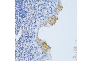 Immunohistochemistry of paraffin-embedded human appendix using CRA antibody (ABIN6132087, ABIN6138999, ABIN6139001 and ABIN6217973) at dilution of 1:150 (40x lens). (EFCAB4B Antikörper  (AA 1-200))
