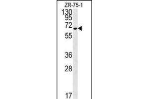 N4BP3 Antibody (N-term) (ABIN651821 and ABIN2840413) western blot analysis in ZR-75-1 cell line lysates (15 μg/lane). (N4BP3 Antikörper  (N-Term))
